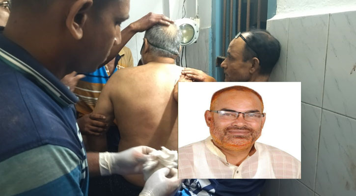 ইউপি চেয়ারম্যানকে কুপিয়ে জখম